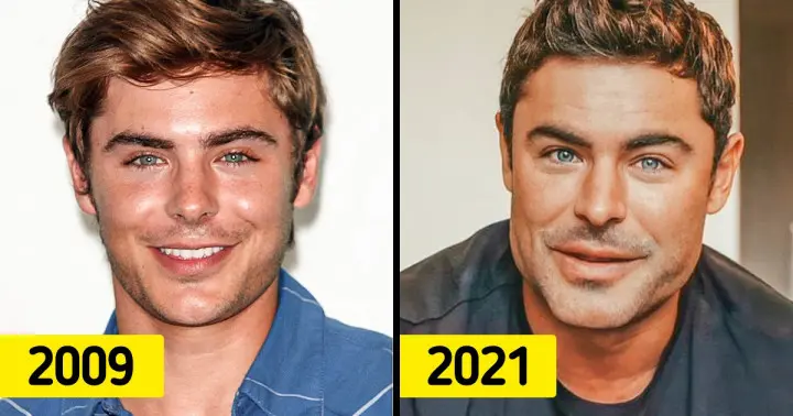 “Majdnem belehaltam” – Zac Efron végre felfedi, miért alakult át arcának arculata