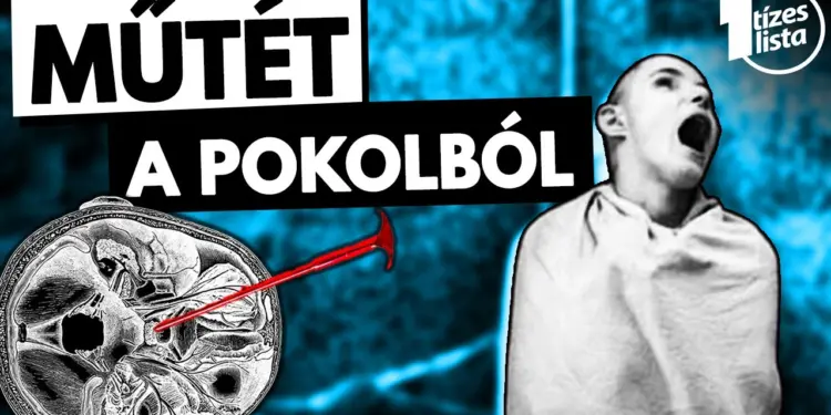 Az orvostudomány sötét oldala – A LOBOTÓMIA – videó