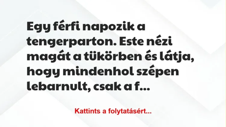 Vicc: Egy férfi napozik a tengerparton. Este nézi magát a tükörben és látja,…