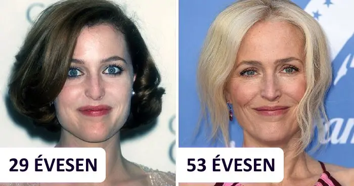 Természetesen öregedő hírességek: 15 sztár, aki elutasítja a plasztikai sebészetet és a botoxot