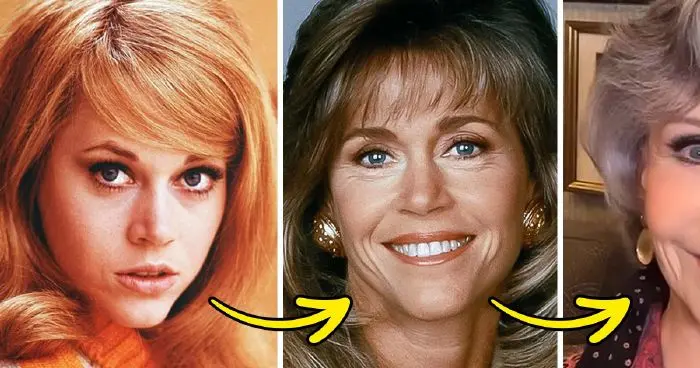 Jane Fonda arcfelvarrást bánta meg: elő a fiataloknak