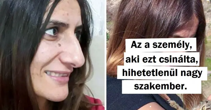 A plasztikai sebészet igazi csodái – 20+ nő, aki bátran váltotta valóra tökéletességre irányuló álmait