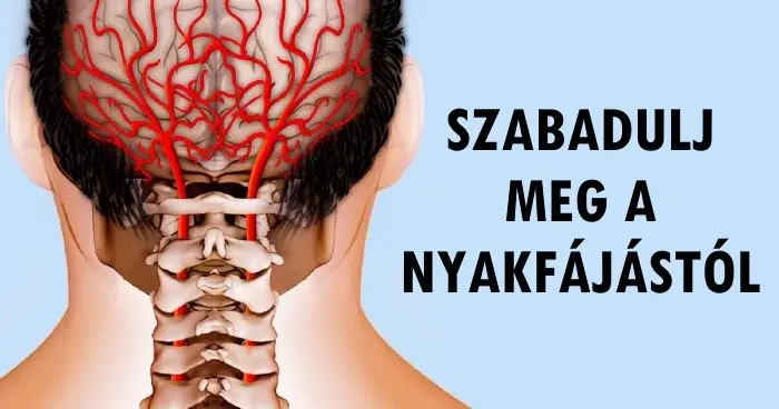 A félelemtől az önbizalomig: 7 hatékony módszer a nyaki fájdalom leküzdésére