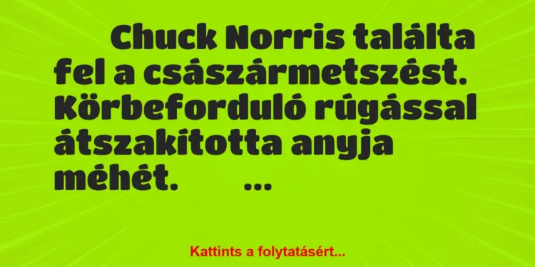 Vicc:
Chuck Norris találta fel a császármetszést….