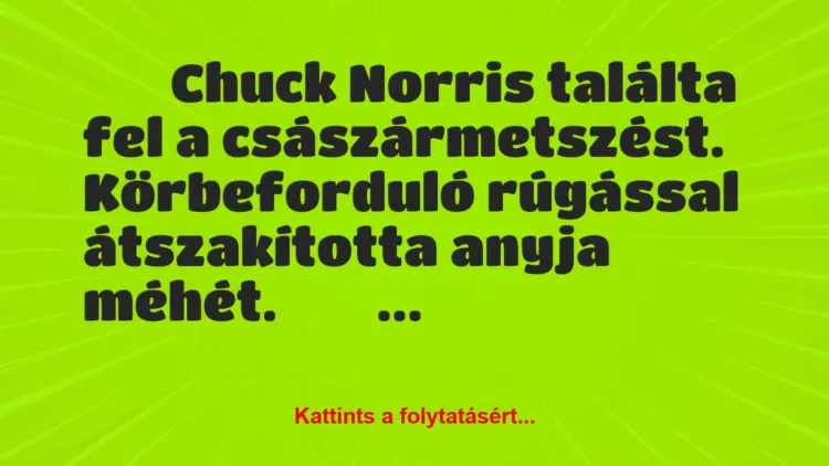 Vicc:
Chuck Norris találta fel a császármetszést….