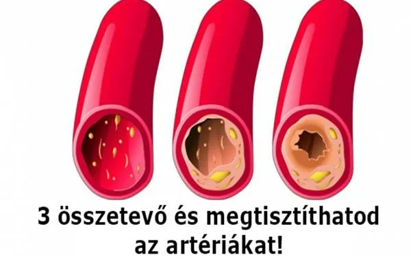 Távolítsuk el a szívérrendszer lerakódásait, használva ez a 3 természetes alapanyag!