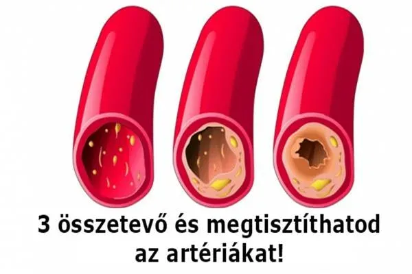 Távolítsuk el a szívérrendszer lerakódásait, használva ez a 3 természetes alapanyag!